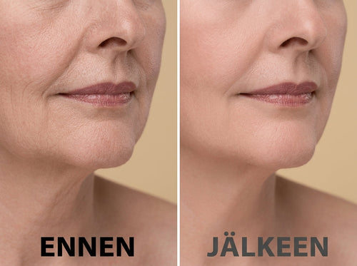 MultiBalm – Maksimaalinen täyteläisyys