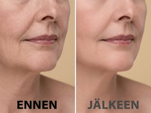 MultiBalm – Maksimaalinen täyteläisyys